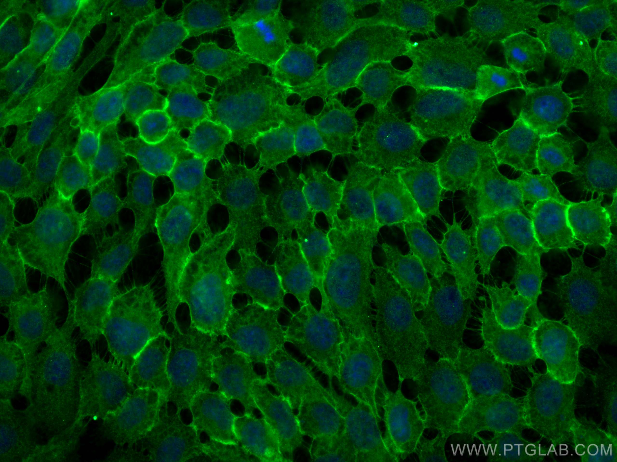 Immunofluorescence (IF) / fluorescent staining of A431 cells using E-cadherin Polyclonal antibody (20874-1-AP)