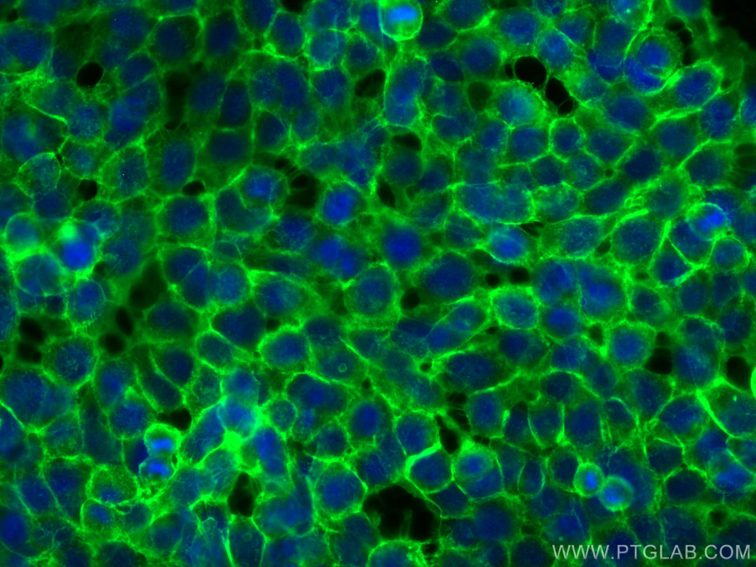 Immunofluorescence (IF) / fluorescent staining of A431 cells using E-cadherin Polyclonal antibody (20874-1-AP)