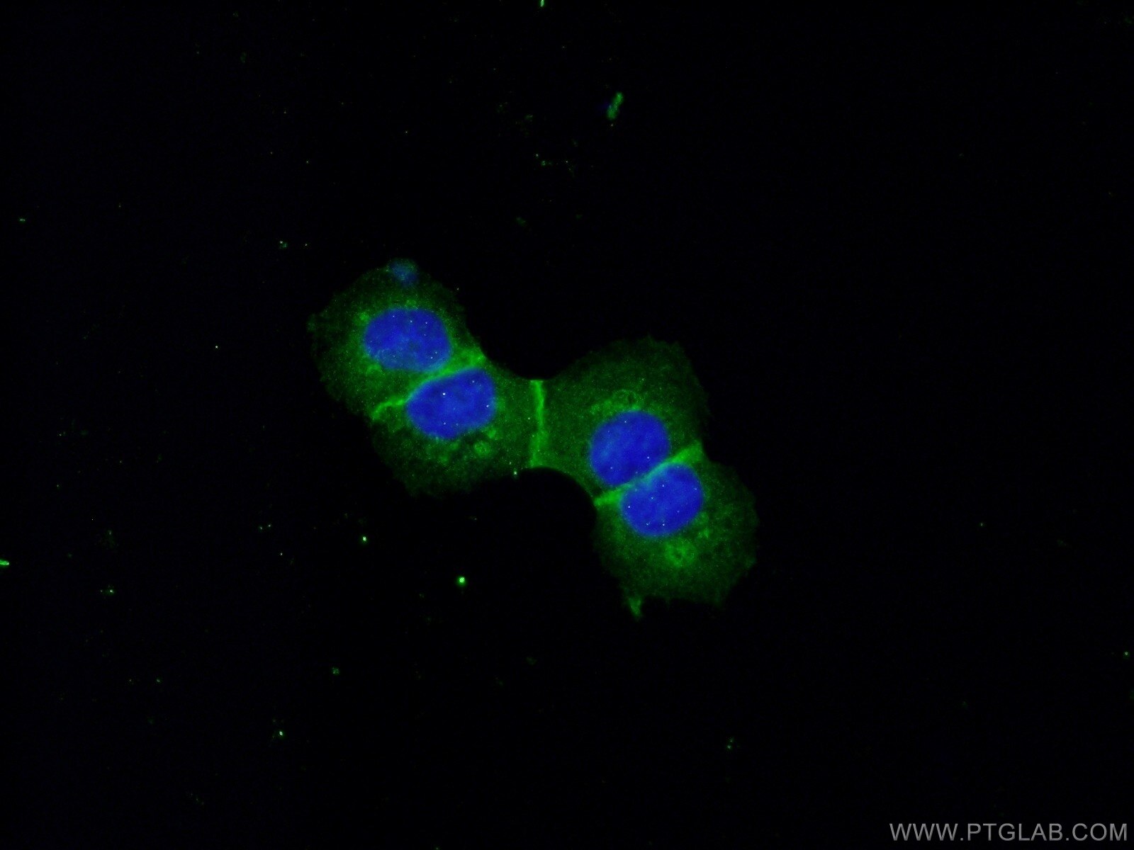 E-cadherin Polyclonal antibody