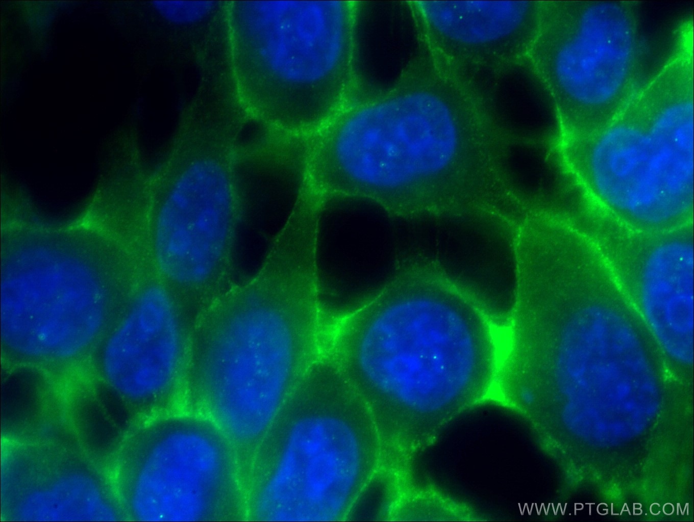 Immunofluorescence (IF) / fluorescent staining of A431 cells using E-cadherin Polyclonal antibody (20874-1-AP)