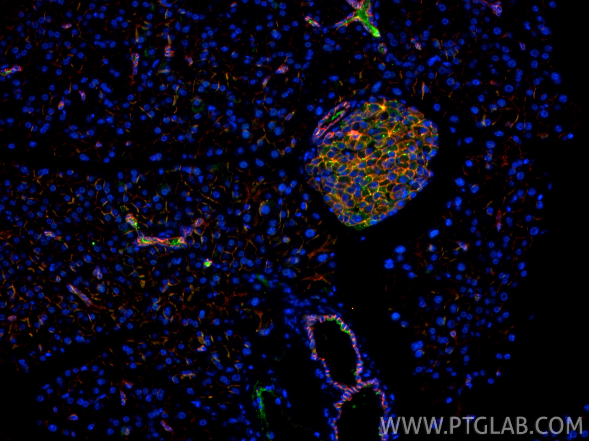 Immunofluorescence (IF) / fluorescent staining of mouse pancreas tissue using E-cadherin Polyclonal antibody (20874-1-AP)