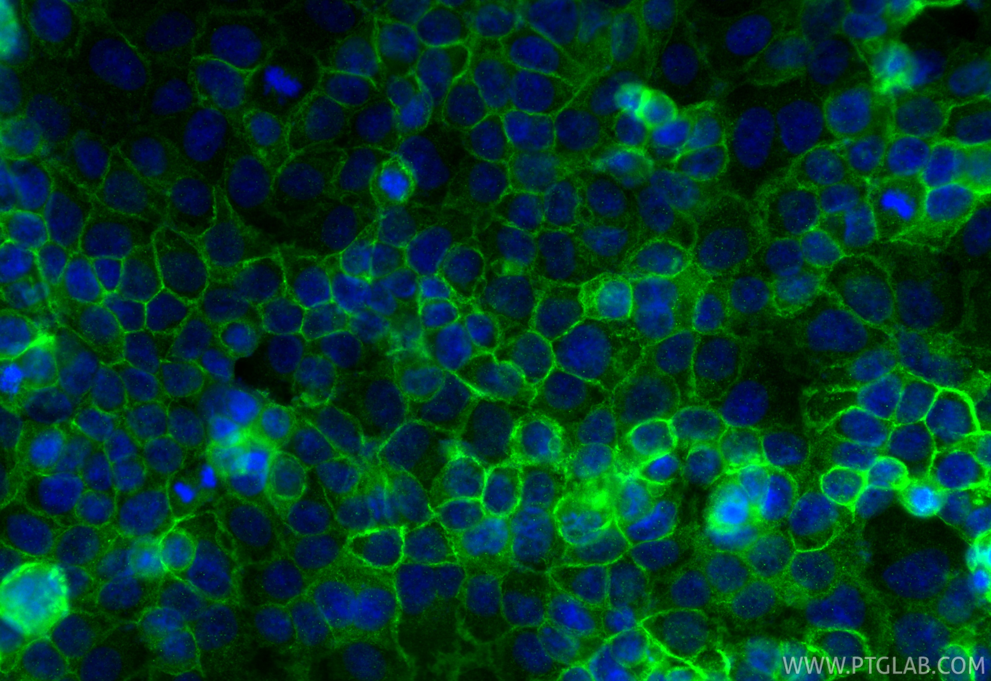 Immunofluorescence (IF) / fluorescent staining of OVCAR-3 cells using E-cadherin Polyclonal antibody (20874-1-AP)