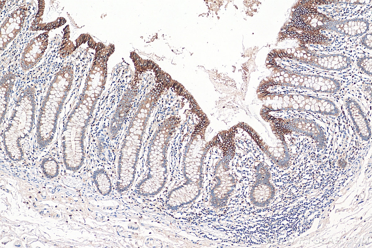 IHC staining of human colon using 20874-1-AP