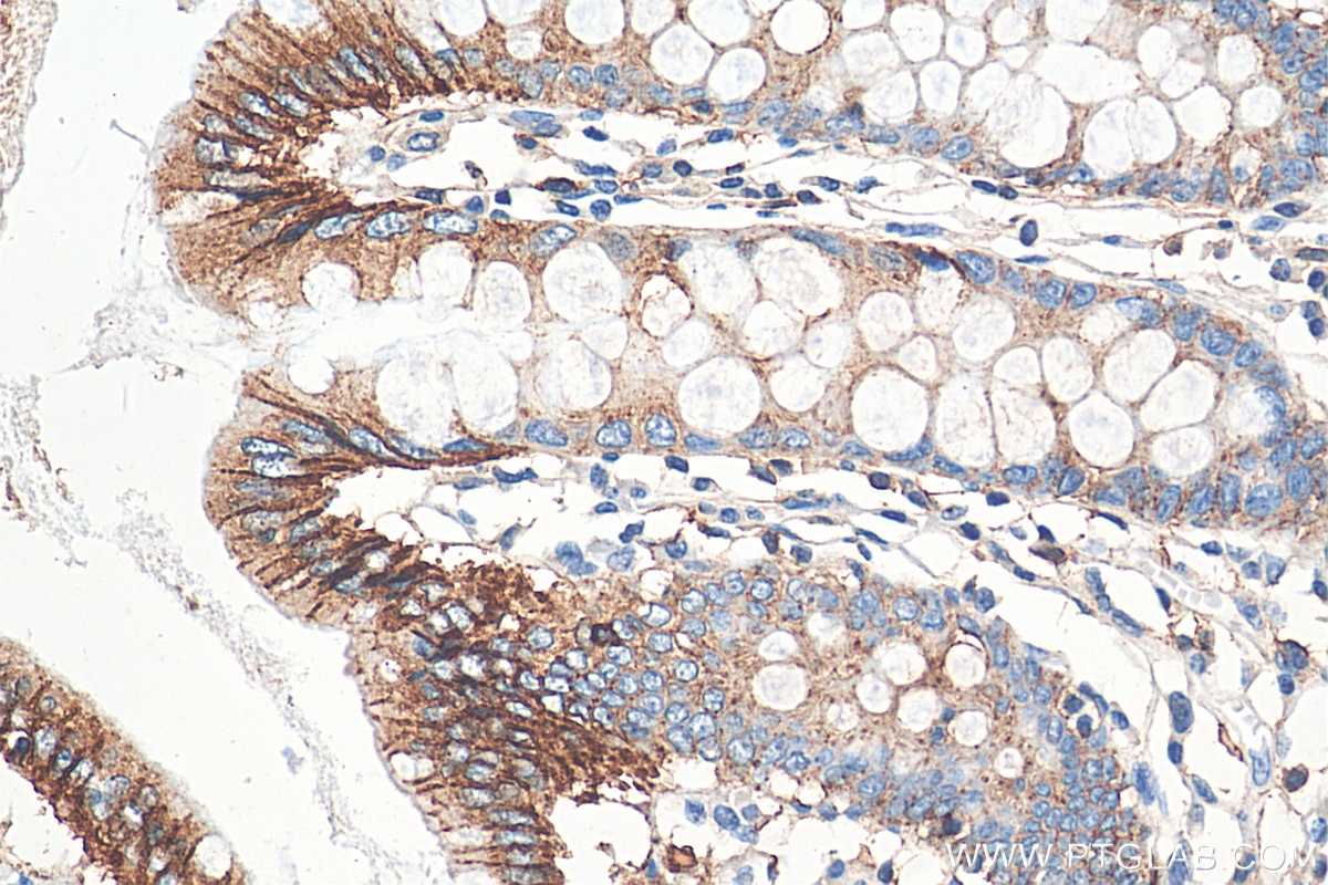 Immunohistochemistry (IHC) staining of human colon tissue using E-cadherin Polyclonal antibody (20874-1-AP)