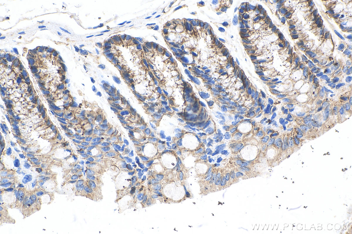 Immunohistochemistry (IHC) staining of mouse colon tissue using E-cadherin Polyclonal antibody (20874-1-AP)