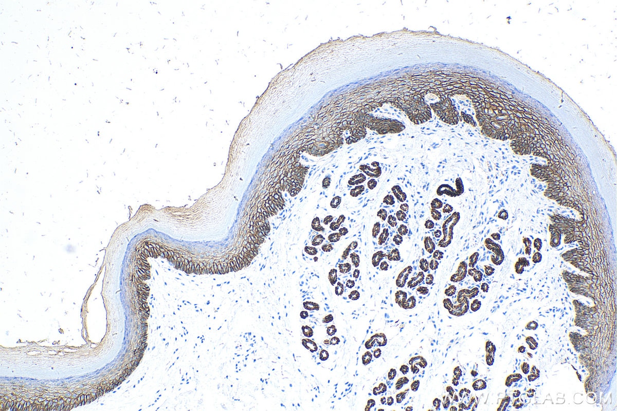 Immunohistochemistry (IHC) staining of mouse skin tissue using E-cadherin Polyclonal antibody (20874-1-AP)