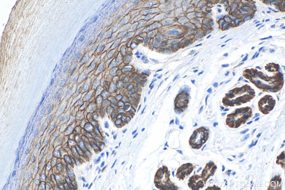 Immunohistochemistry (IHC) staining of mouse skin tissue using E-cadherin Polyclonal antibody (20874-1-AP)