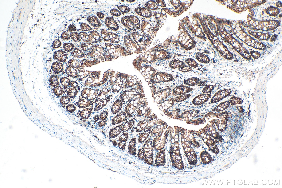 Immunohistochemistry (IHC) staining of mouse colon tissue using E-cadherin Polyclonal antibody (20874-1-AP)