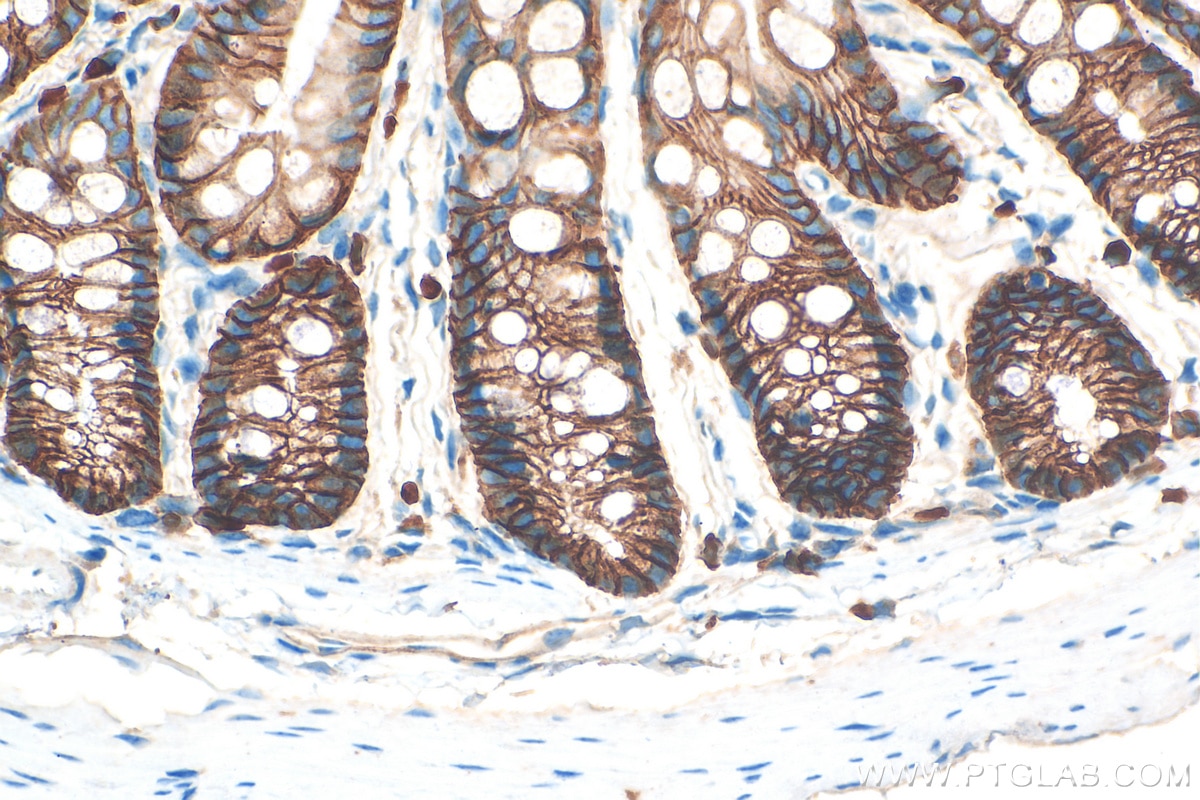 IHC staining of mouse colon using 20874-1-AP