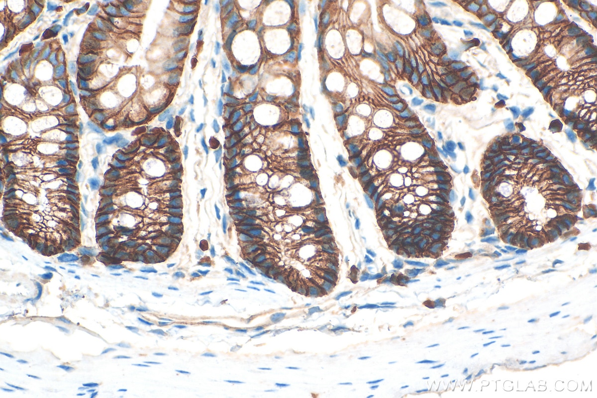 Immunohistochemistry (IHC) staining of mouse colon tissue using E-cadherin Polyclonal antibody (20874-1-AP)