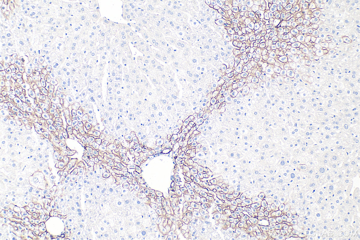 Immunohistochemistry (IHC) staining of mouse liver tissue using E-cadherin Polyclonal antibody (20874-1-AP)