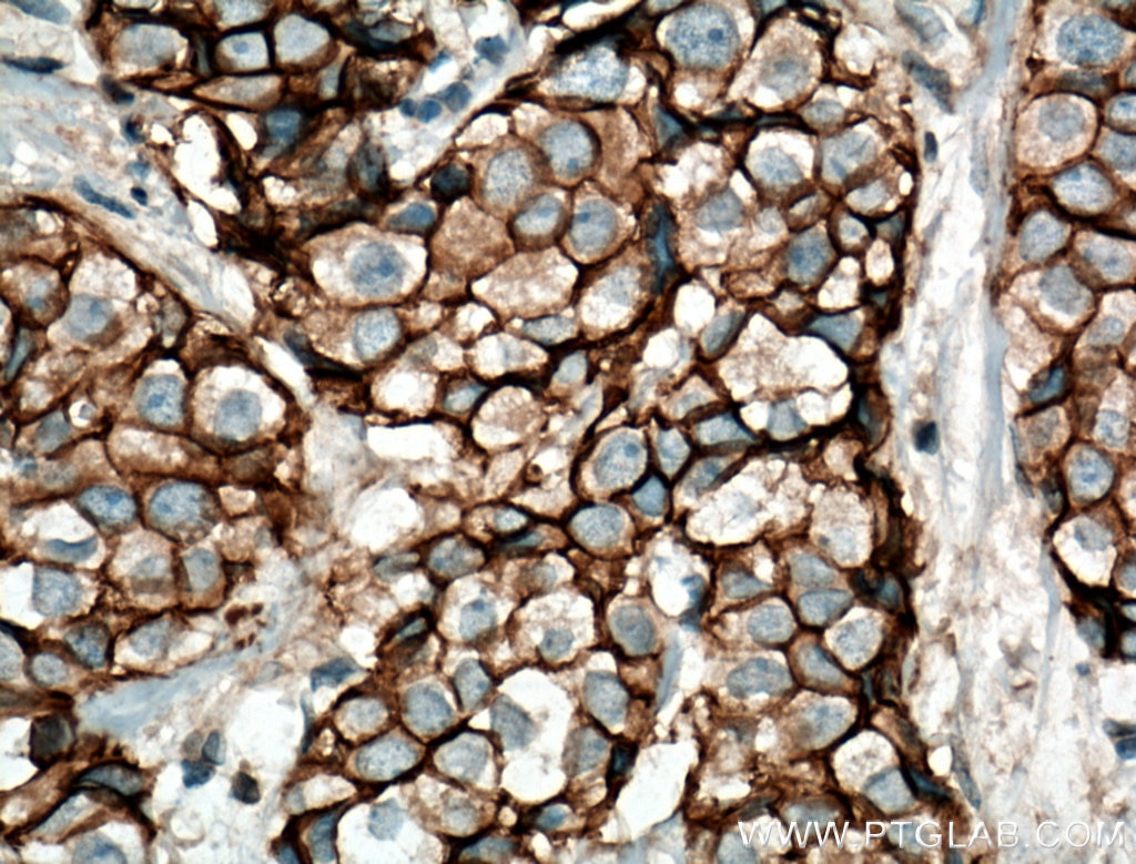 E-cadherin Polyclonal antibody