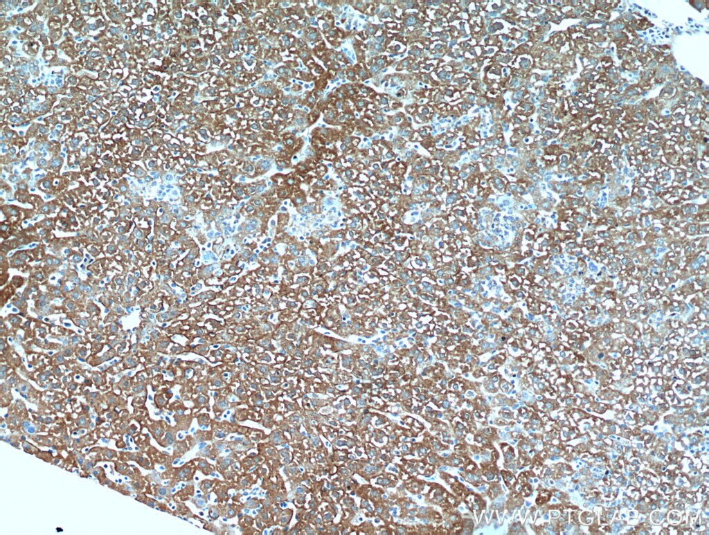 IHC staining of mouse liver using 20874-1-AP