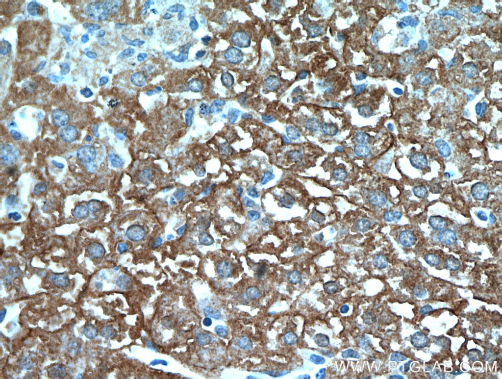 IHC staining of mouse liver using 20874-1-AP