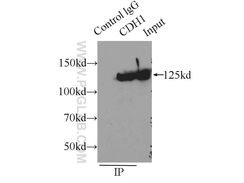 Immunoprecipitation (IP) experiment of A431 cells using E-cadherin Polyclonal antibody (20874-1-AP)
