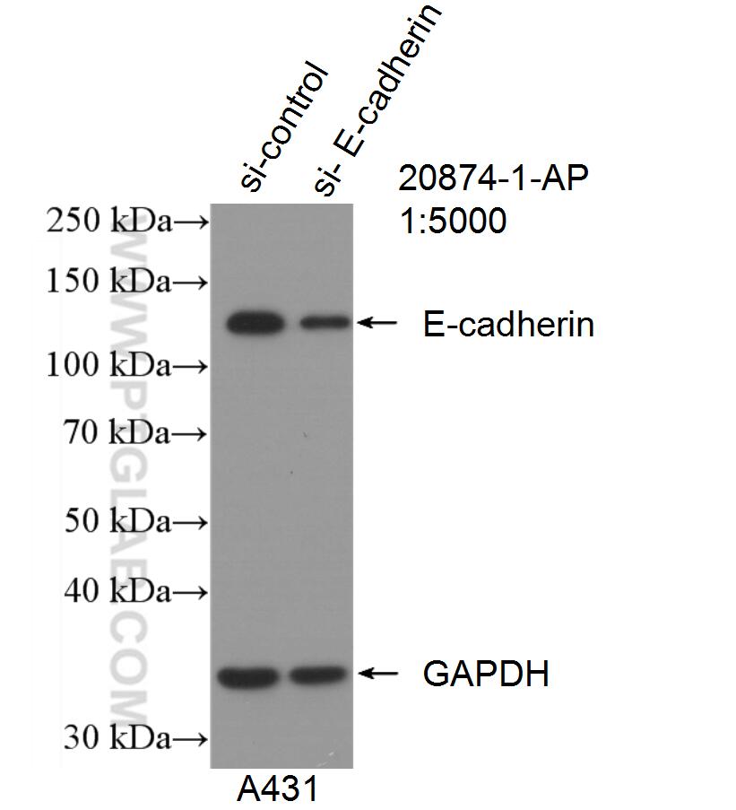 Western Blot (WB) analysis of A431 cells using E-cadherin Polyclonal antibody (20874-1-AP)