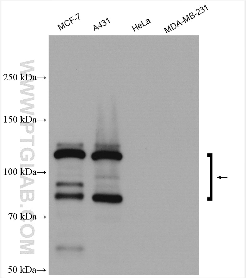 Western Blot (WB) analysis of various lysates using E-cadherin Polyclonal antibody (20874-1-AP)