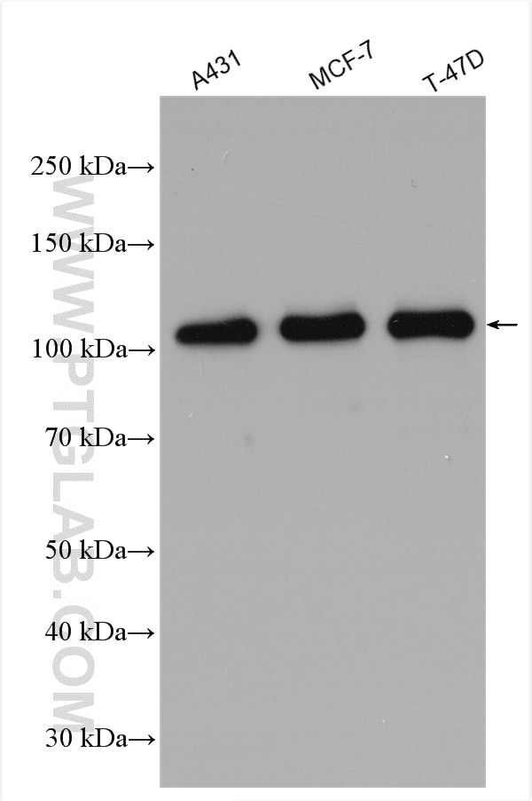 Western Blot (WB) analysis of various lysates using E-cadherin Polyclonal antibody (20874-1-AP)