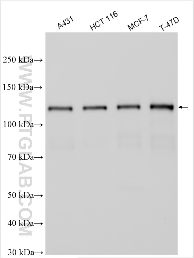 Western Blot (WB) analysis of various lysates using E-cadherin Polyclonal antibody (20874-1-AP)