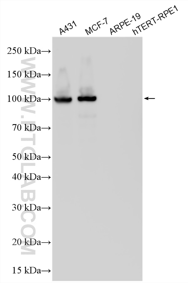 WB analysis using 20874-1-AP Western Blot (WB) analysis of various lysates using E-cadherin Polyclonal antibody (20874-1-AP)