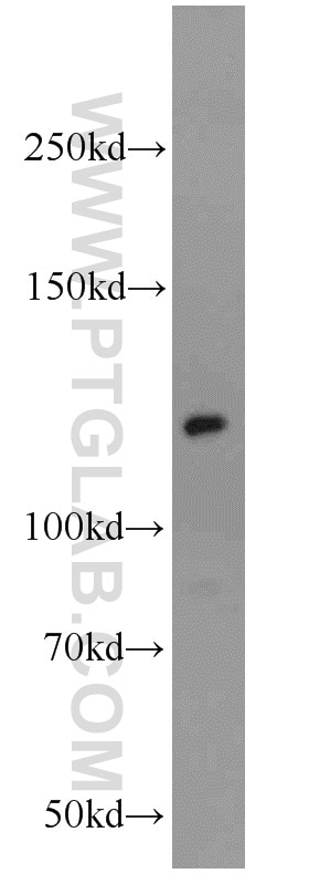 E-cadherin Polyclonal antibody