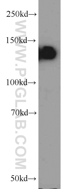 Western Blot (WB) analysis of DU 145 cells using E-cadherin Polyclonal antibody (20874-1-AP)