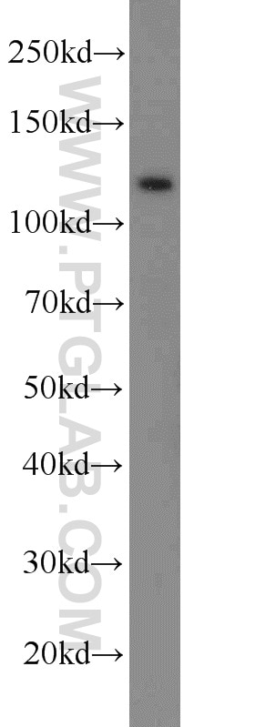 Western Blot (WB) analysis of mouse testis tissue using E-cadherin Polyclonal antibody (20874-1-AP)