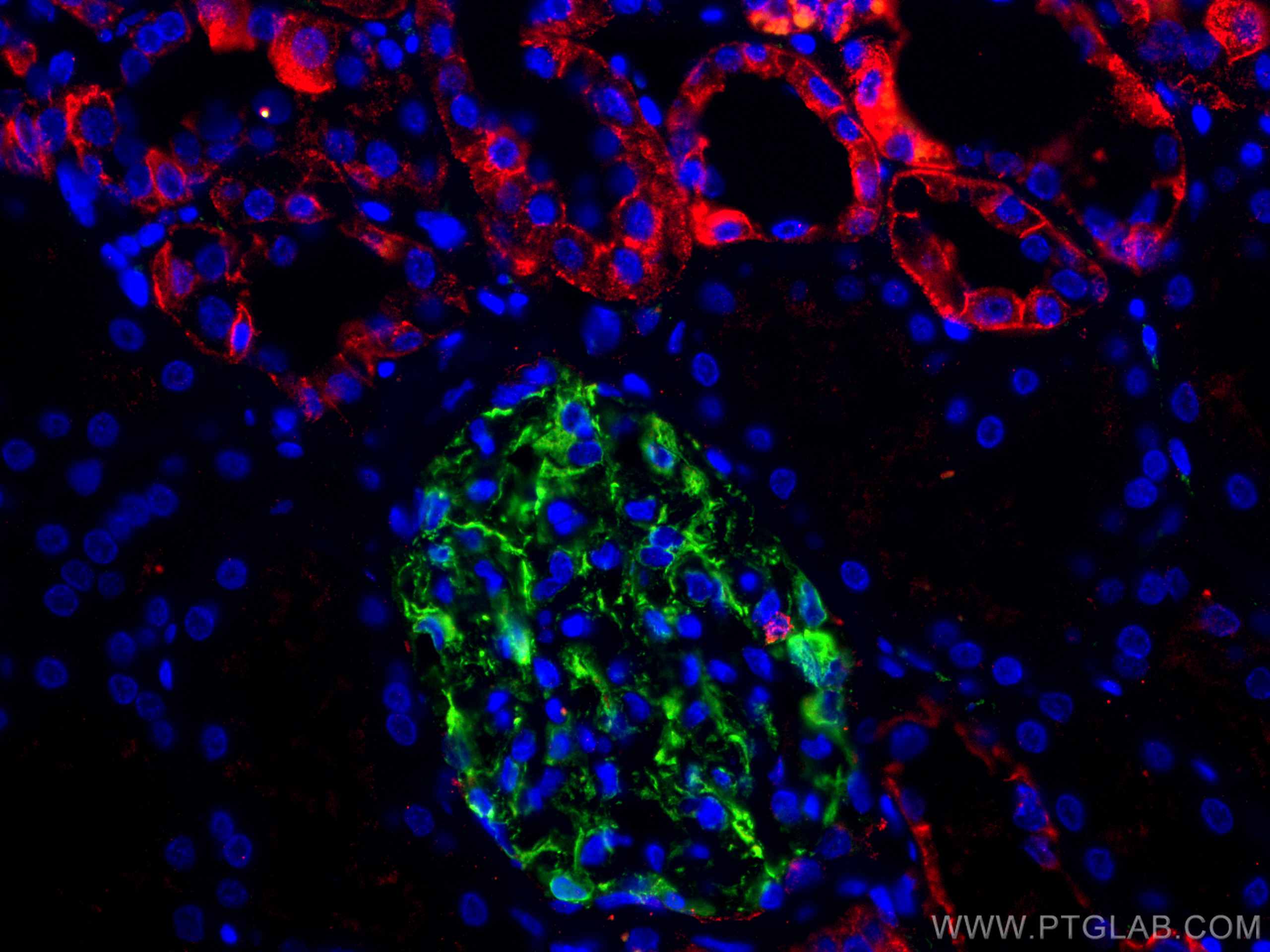 Immunofluorescence (IF) / fluorescent staining of human kidney tissue using E-cadherin Monoclonal antibody (60335-1-Ig)