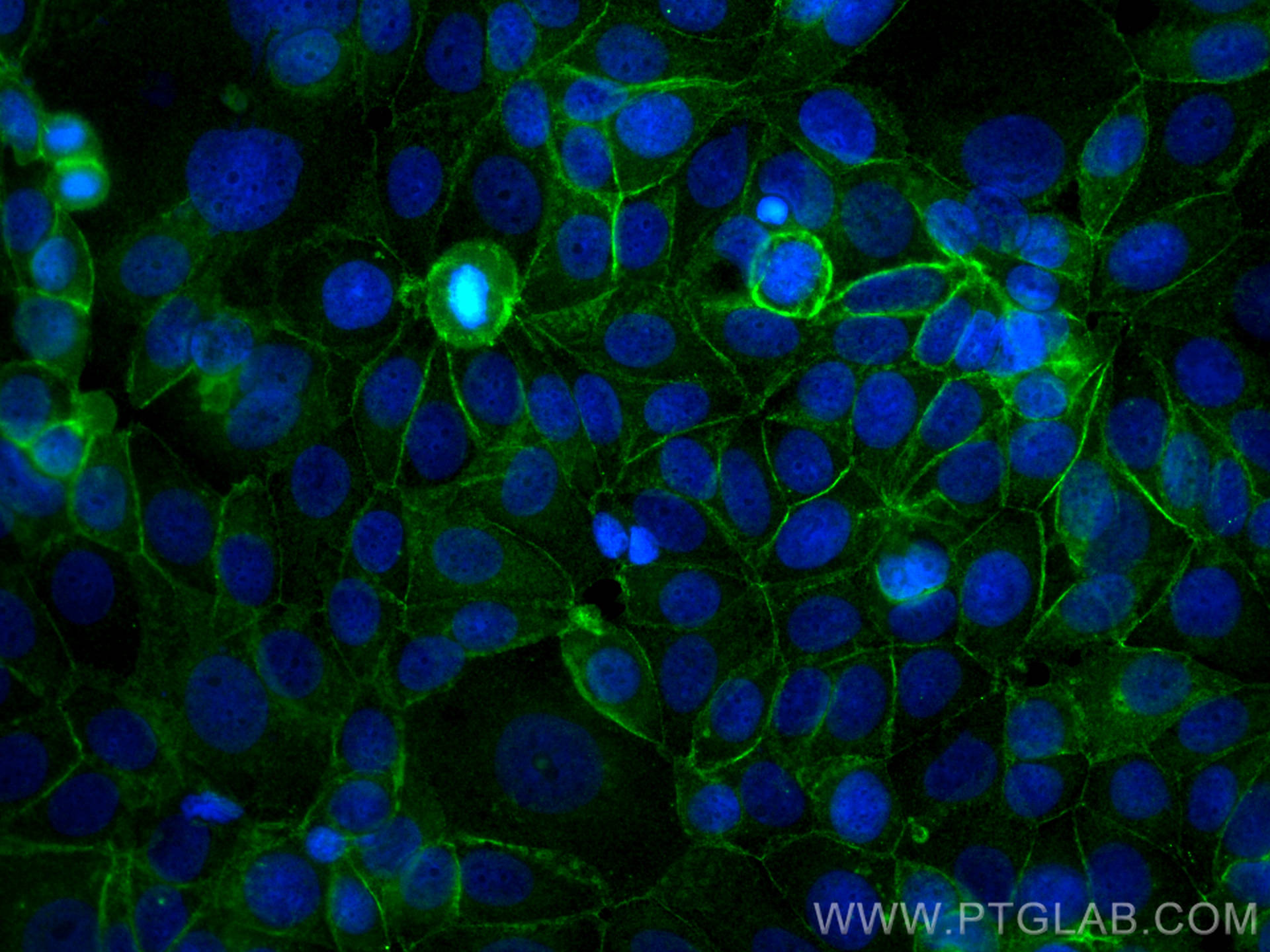Immunofluorescence (IF) / fluorescent staining of MCF-7 cells using E-cadherin Monoclonal antibody (60335-1-Ig)
