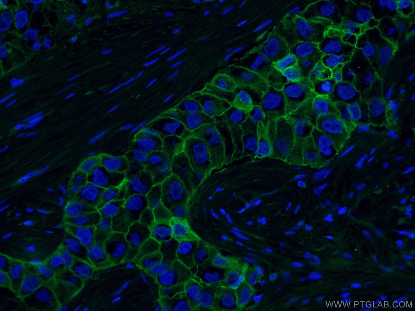 E-cadherin Monoclonal antibody