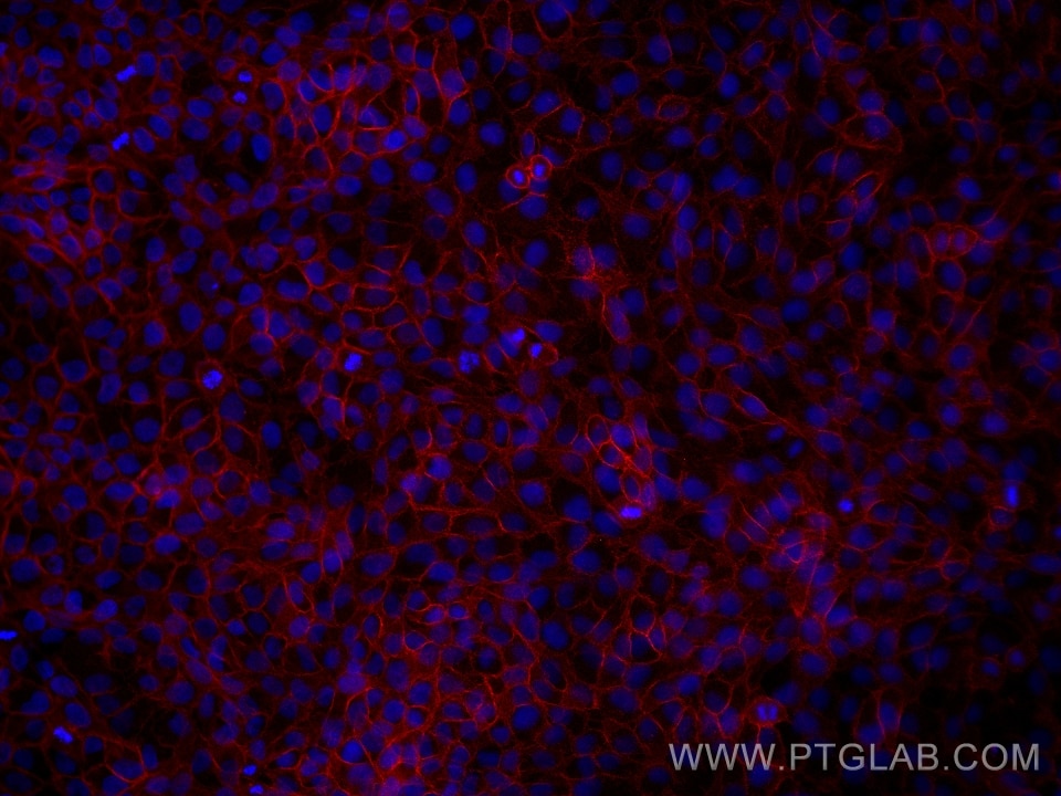 Immunofluorescent analysis of (4% PFA) fixed HaCaT cells using E-cadherin antibody (60335-1-Ig, Clone: 6B11F11 ) at dilution of 1:2000 and Multi-rAb CoraLite® Plus 594-Goat Anti-Mouse Recombinant Secondary Antibody (H+L) (Cat.NO. RGAM004 ). Immunofluorescence (IF) / fluorescent staining of HaCaT cells using E-cadherin Monoclonal antibody (60335-1-Ig)