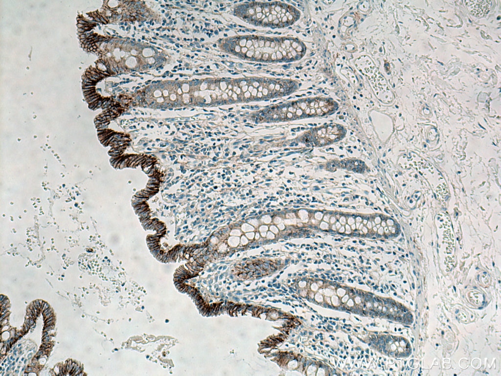 Immunohistochemistry (IHC) staining of human colon tissue using E-cadherin Monoclonal antibody (60335-1-Ig)