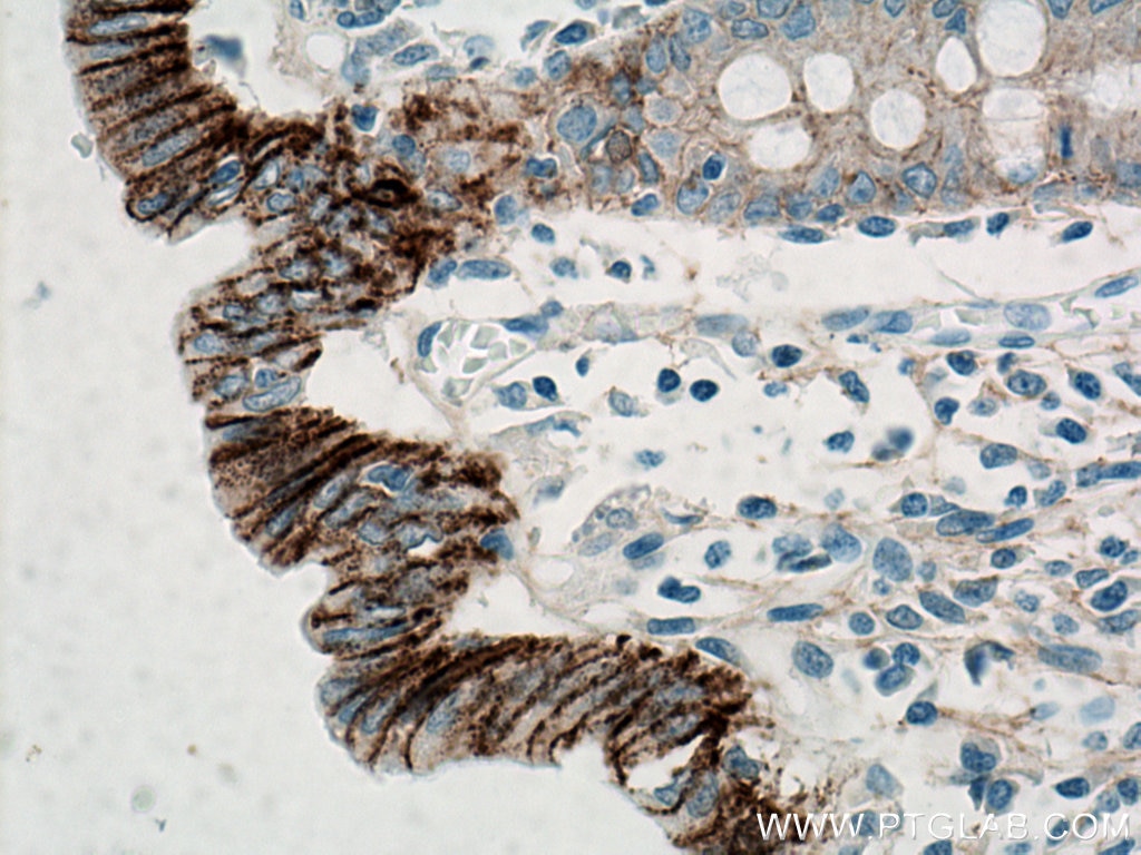 IHC staining of human colon using 60335-1-Ig