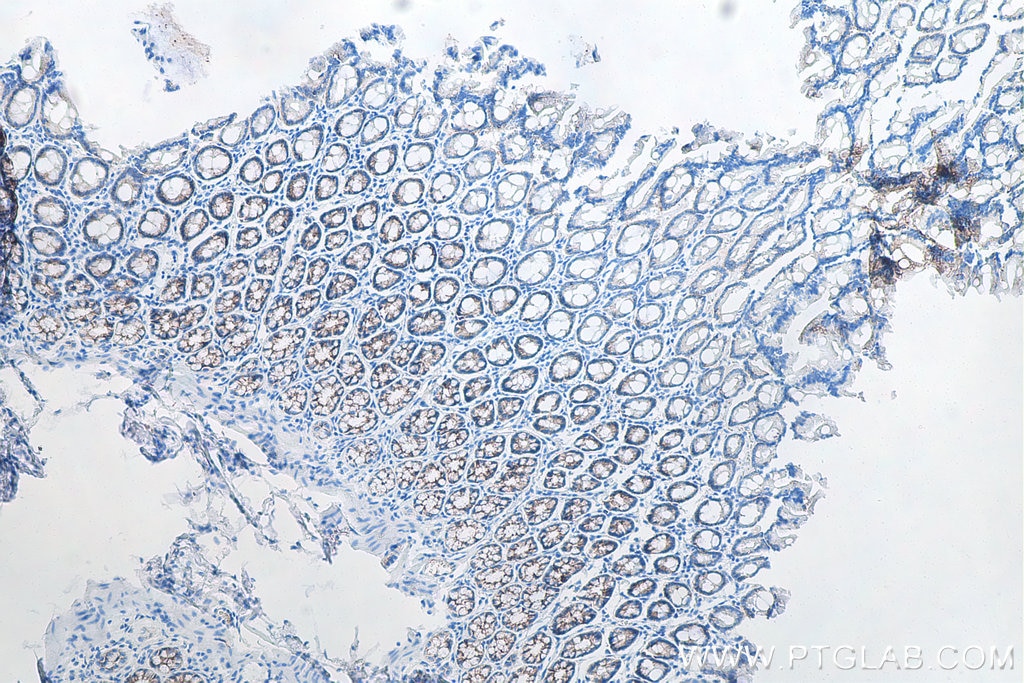 IHC staining of rat colon using 60335-1-Ig Immunohistochemistry (IHC) staining of rat colon tissue using E-cadherin Monoclonal antibody (60335-1-Ig)