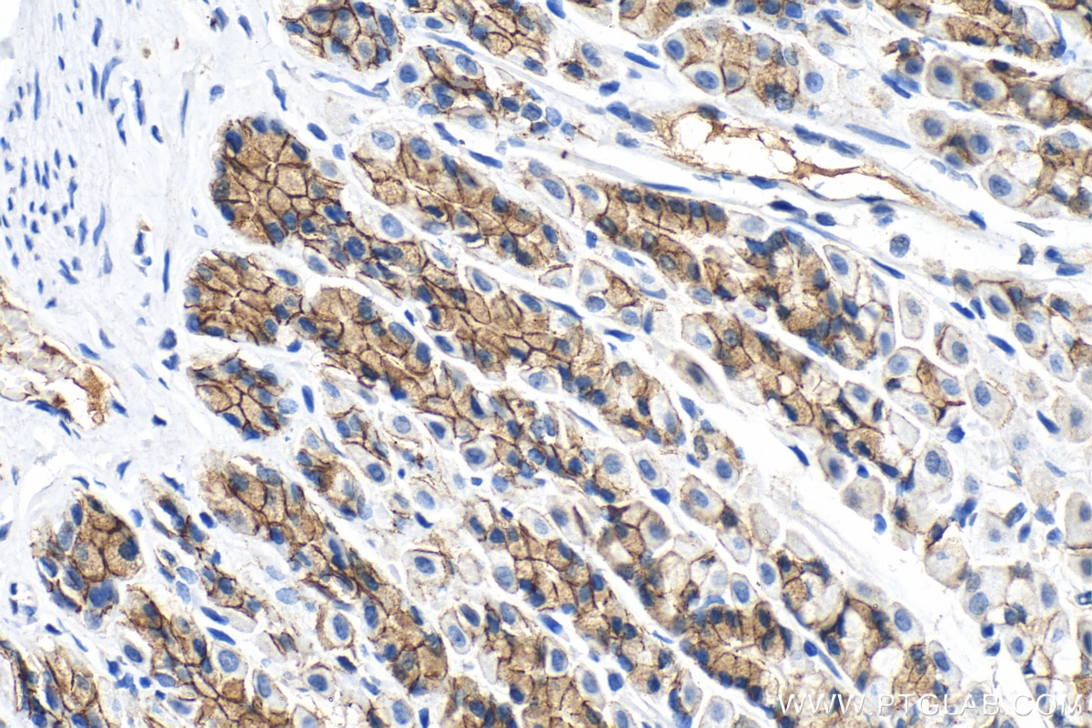 Immunohistochemistry (IHC) staining of rat stomach tissue using E-cadherin Monoclonal antibody (60335-1-Ig)