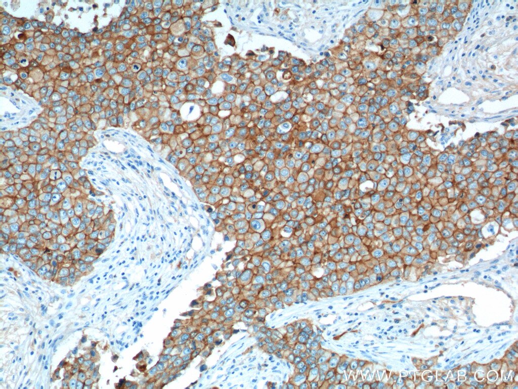 E-cadherin Monoclonal antibody