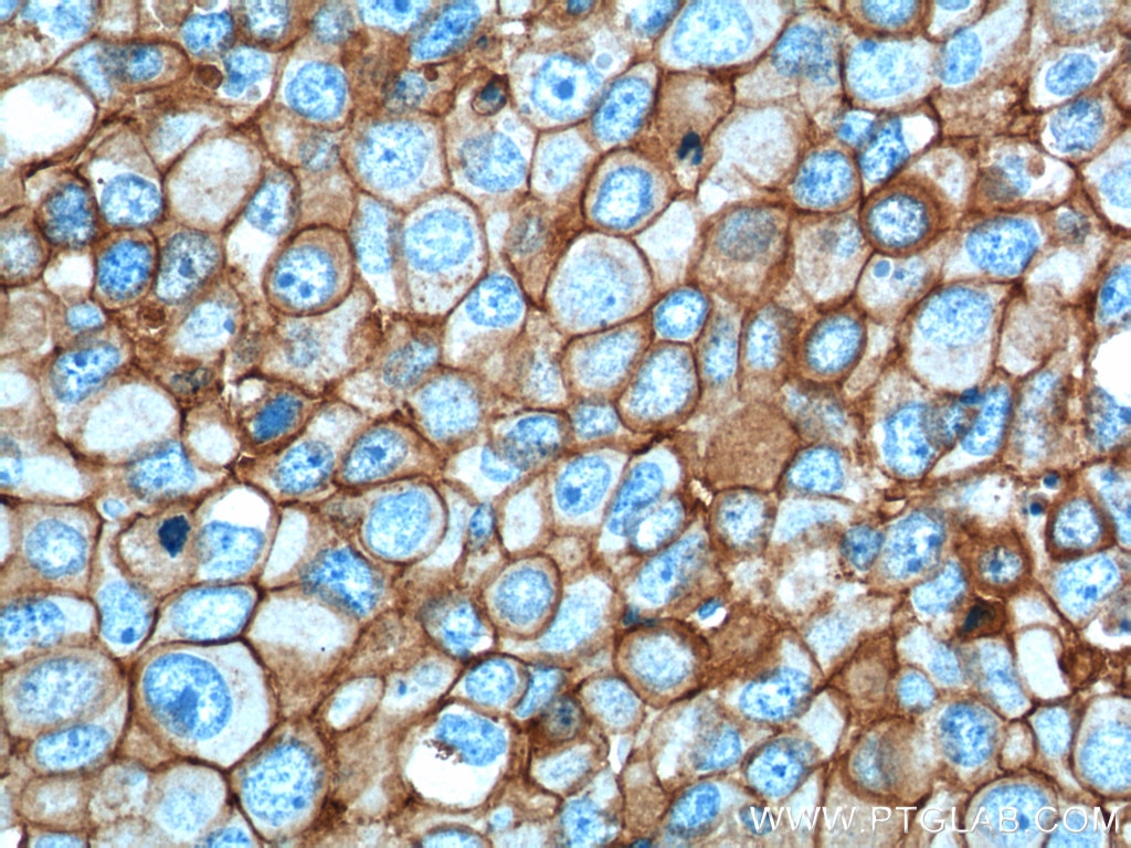 E-cadherin Monoclonal antibody