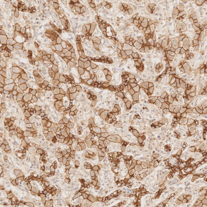 Immunohistochemistry (IHC) staining of human liver tissue using E-cadherin Monoclonal antibody (60335-1-Ig)