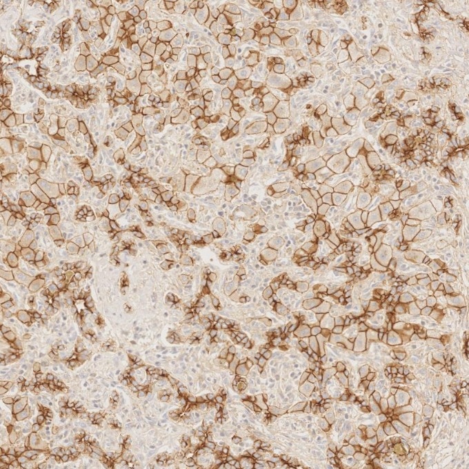 Immunohistochemistry (IHC) staining of human liver tissue using E-cadherin Monoclonal antibody (60335-1-Ig)