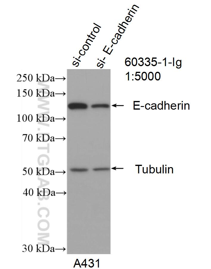 Western Blot (WB) analysis of A431 cells using E-cadherin Monoclonal antibody (60335-1-Ig)