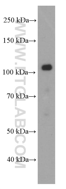 Western Blot (WB) analysis of pig brain tissue using E-cadherin Monoclonal antibody (60335-1-Ig)
