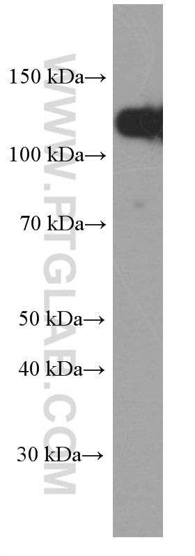 Western Blot (WB) analysis of A431 cells using E-cadherin Monoclonal antibody (60335-1-Ig)
