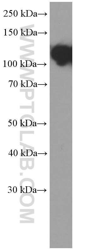 Western Blot (WB) analysis of MCF-7 cells using E-cadherin Monoclonal antibody (60335-1-Ig)