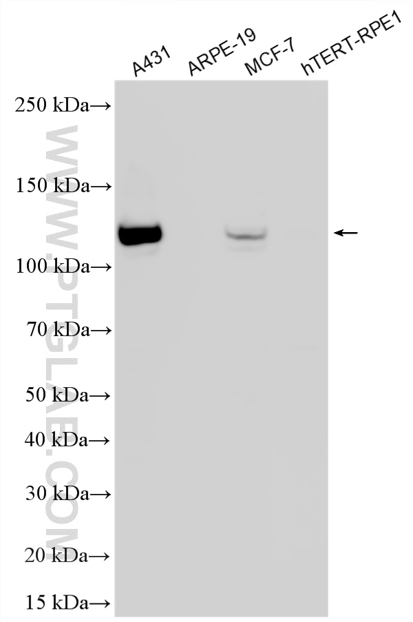 Western Blot (WB) analysis of various lysates using E-cadherin Monoclonal antibody (60335-1-Ig)
