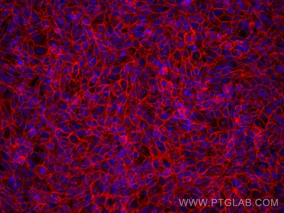 Immunofluorescence (IF) / fluorescent staining of HaCaT cells using E-cadherin Monoclonal antibody (60902-1-Ig)