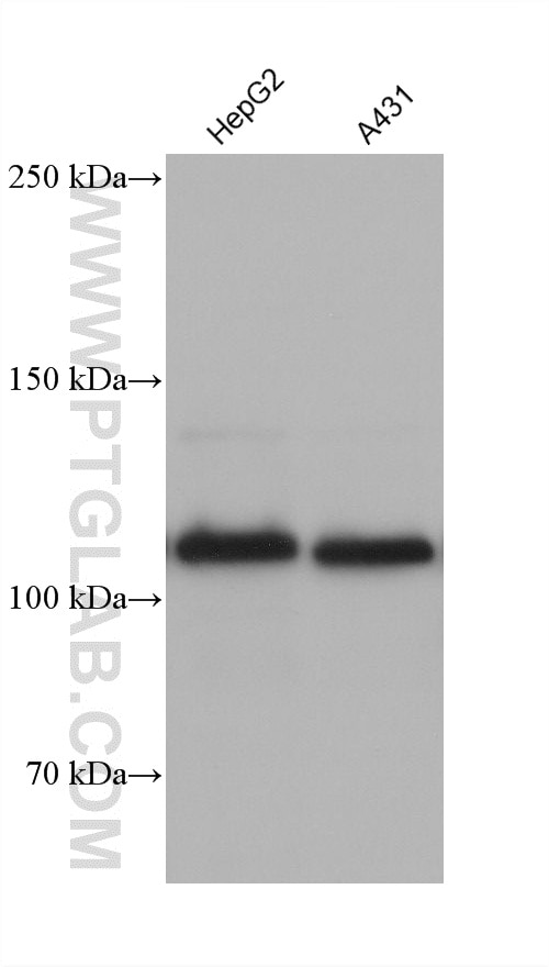 Western Blot (WB) analysis of various lysates using E-cadherin Monoclonal antibody (60902-1-Ig)