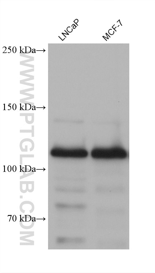 Western Blot (WB) analysis of various lysates using E-cadherin Monoclonal antibody (60902-1-Ig)