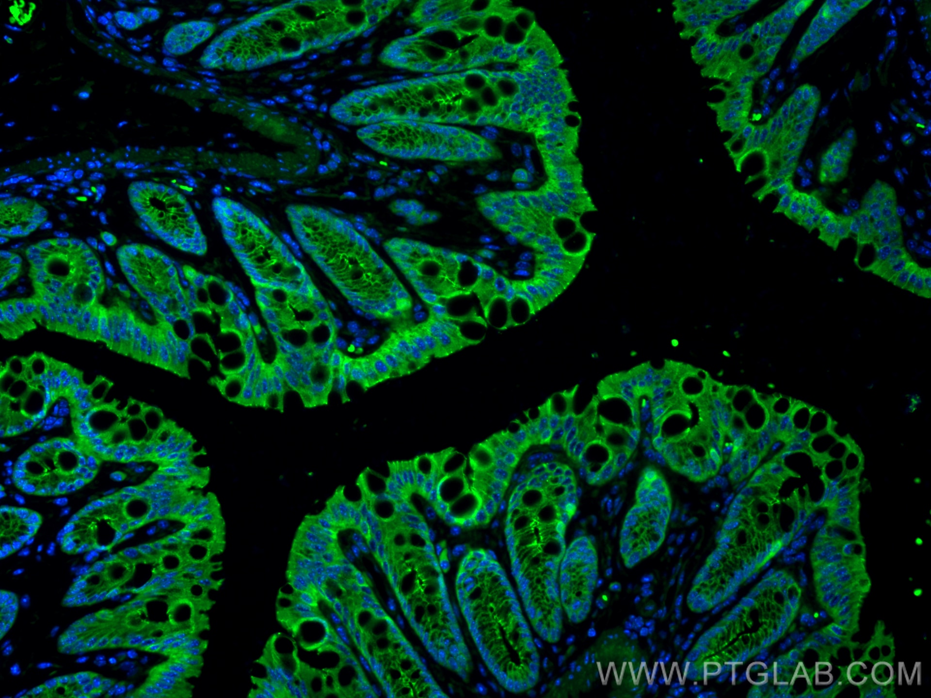 Immunofluorescence (IF) / fluorescent staining of mouse colon tissue using Anti-Mouse CD324 (E-cadherin) (DECMA-1) (65241-1-Ig)