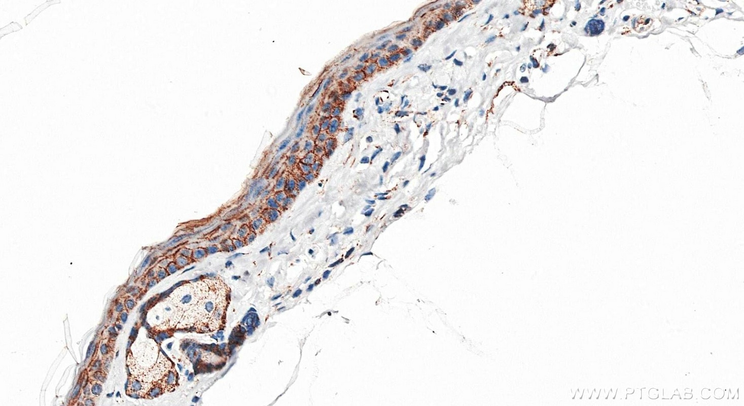 Immunohistochemistry (IHC) staining of mouse skin tissue using E-cadherin Recombinant monoclonal antibody (80541-5-RR)
