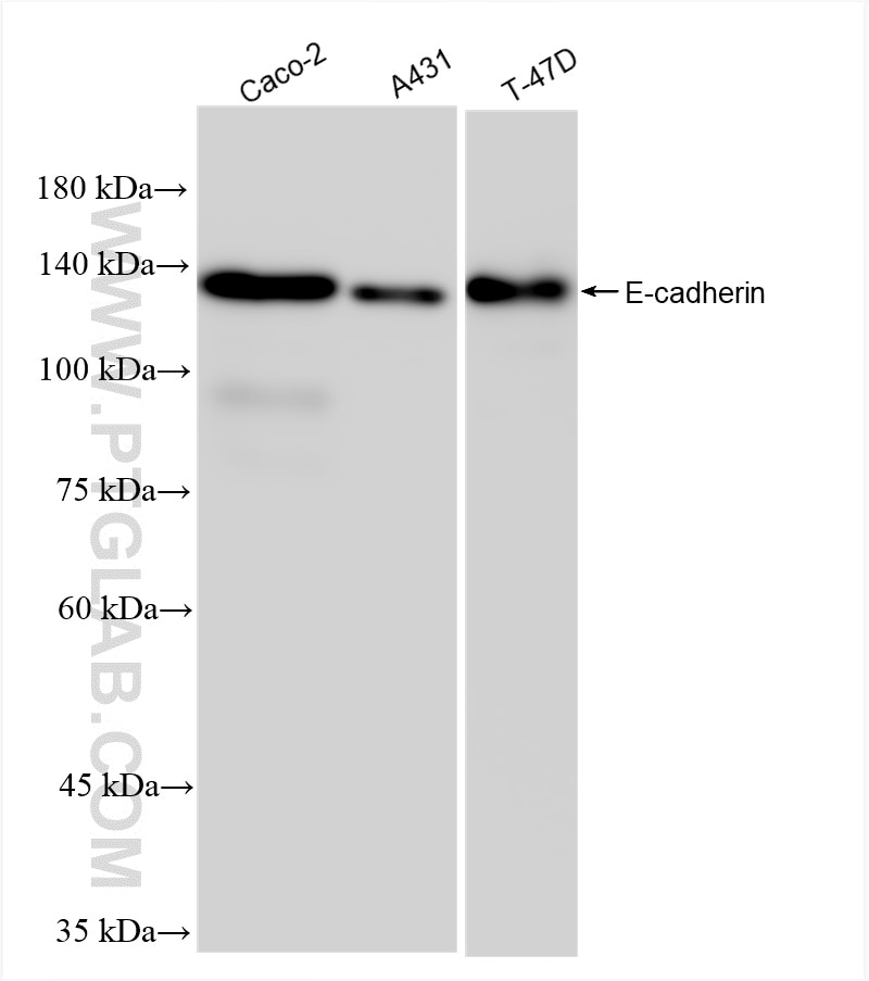 E-cadherin